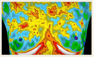 home_thermography